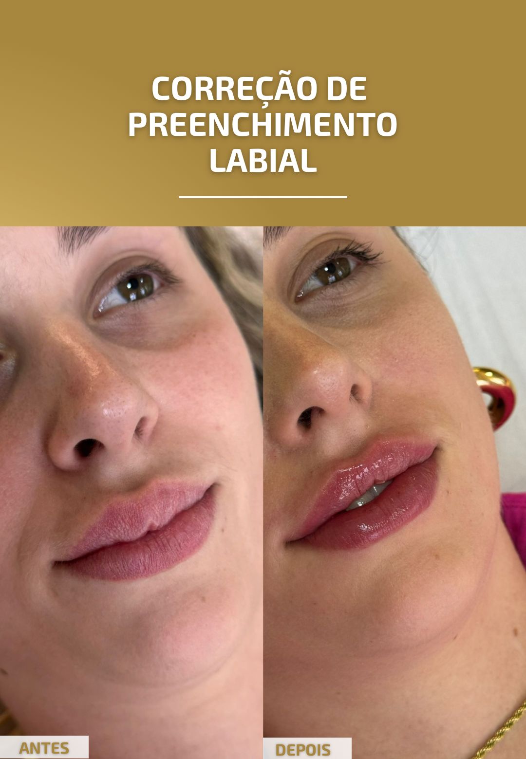 labial